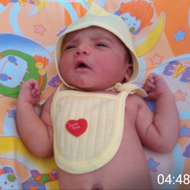 One more case of successful result in Infertility after 3...