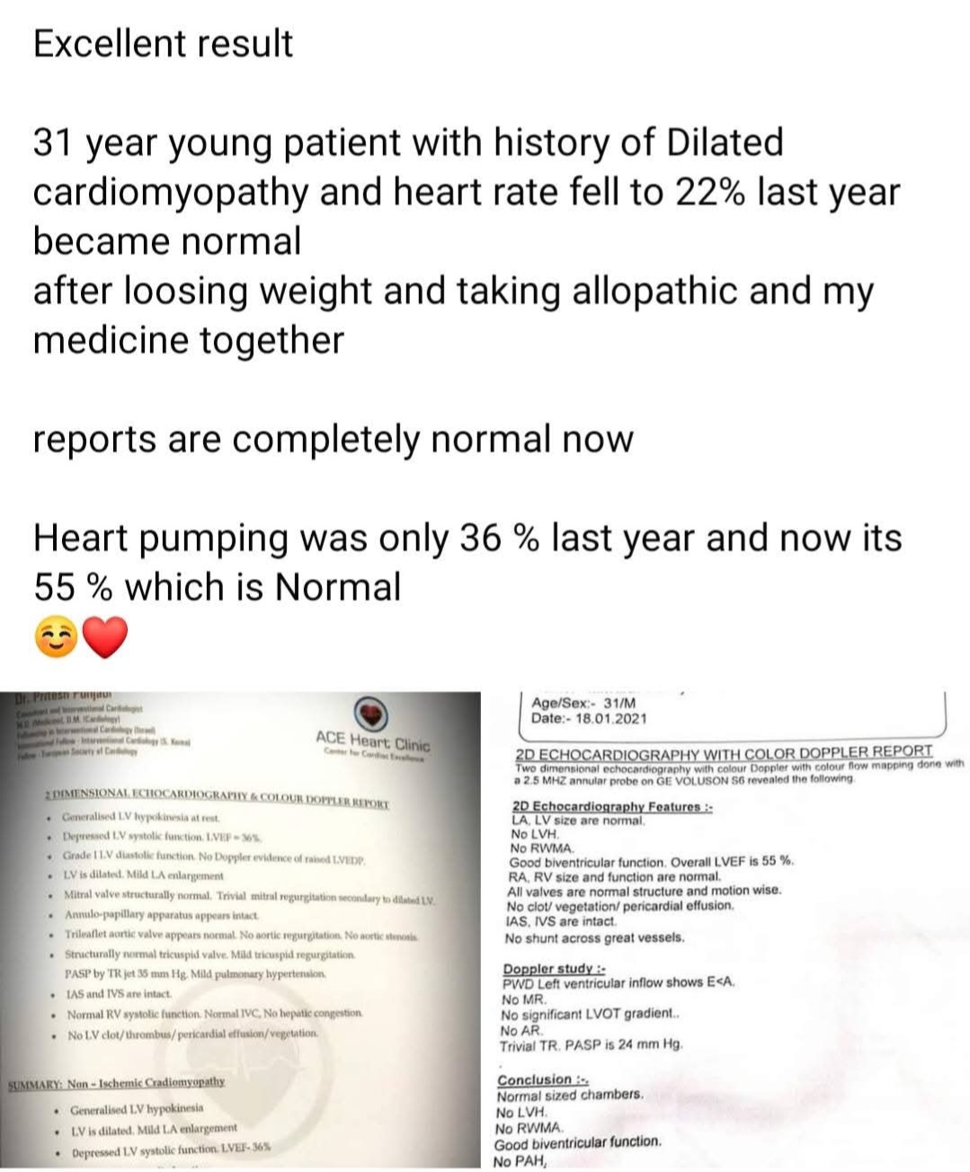 Heart Pumpimg EF NOW 55 FROM 25