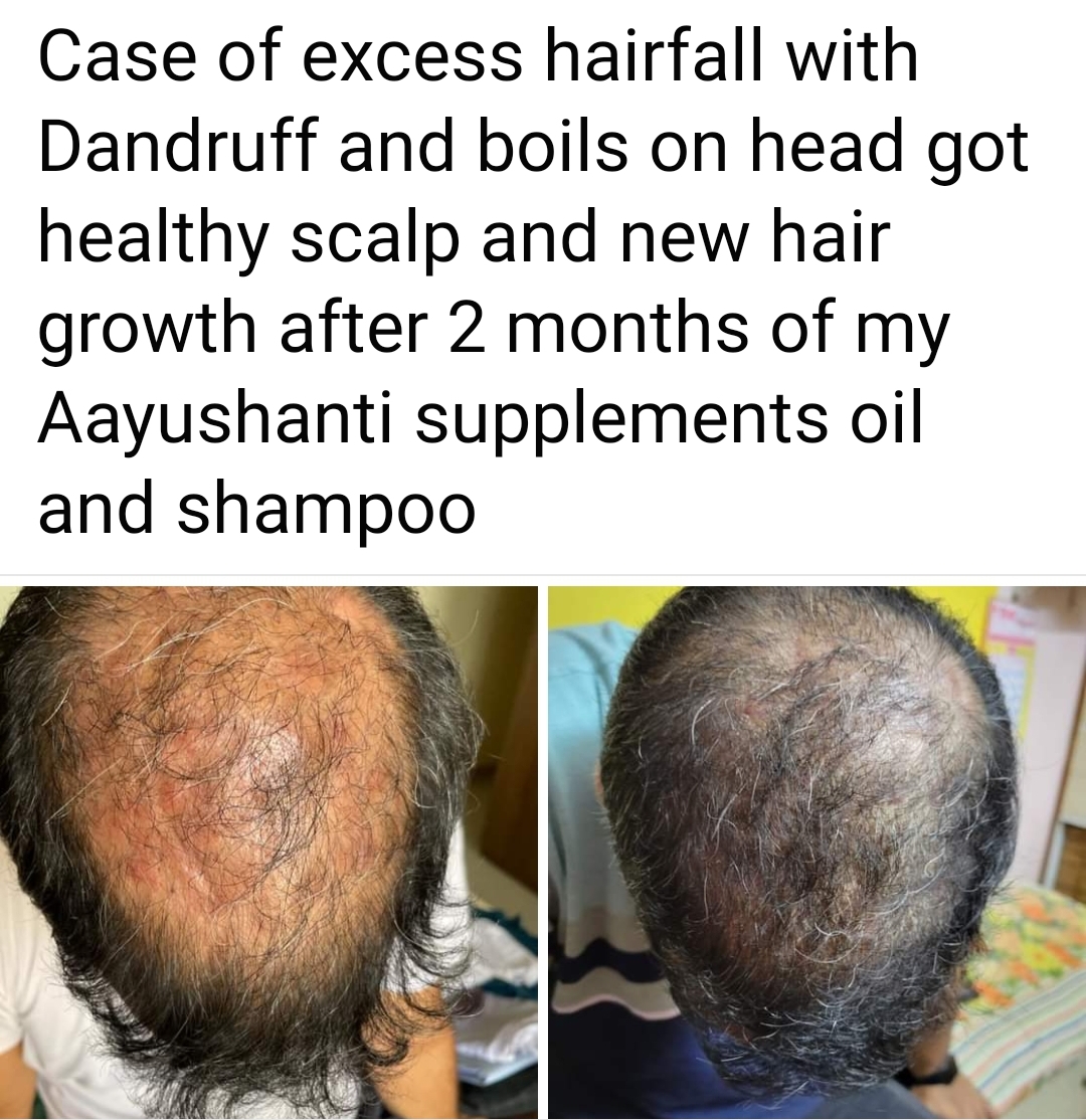New hair growth