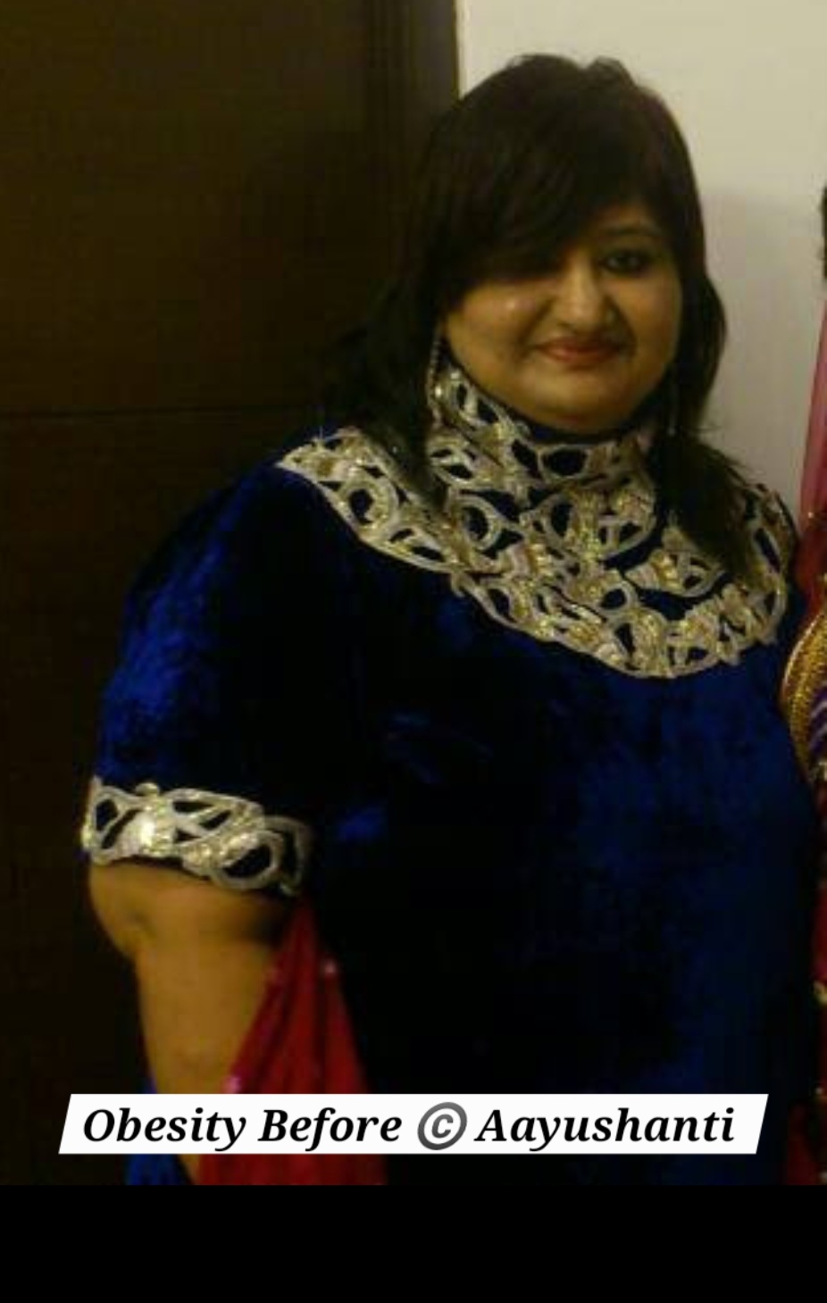 obesity 1 before