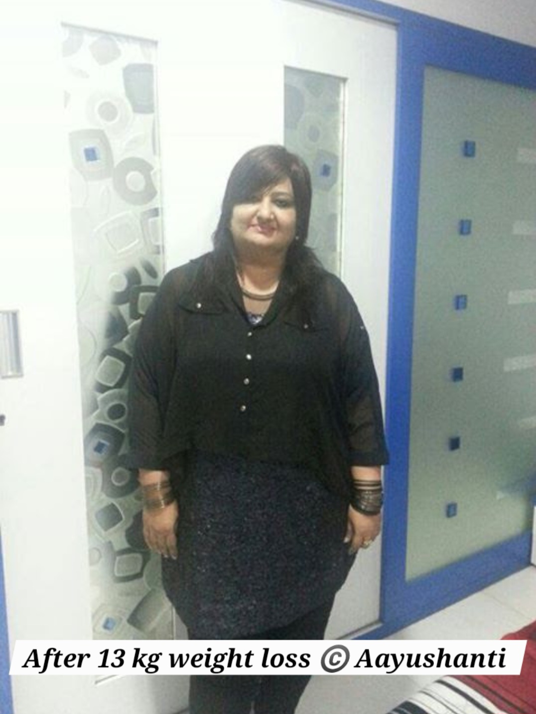 obesity 2 after 13 kg weight loss